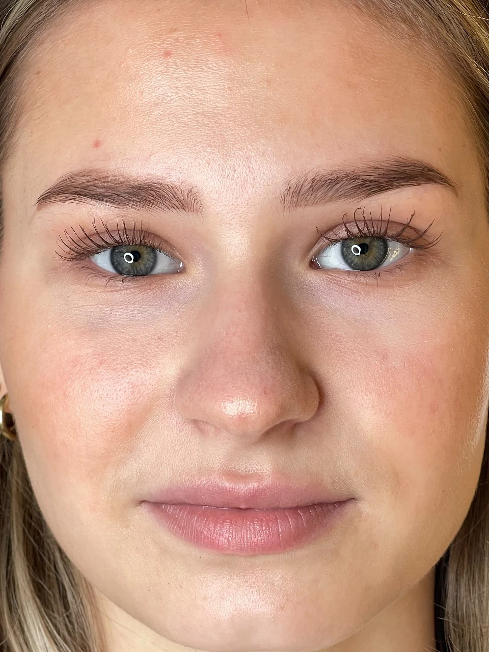 Lippen vor der Pigmentierung derselben Kundin