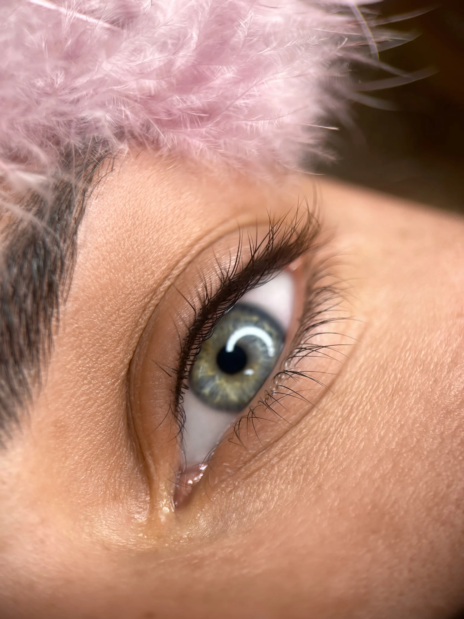 Detailaufnahme einer Wimpernkranzverdichtung.