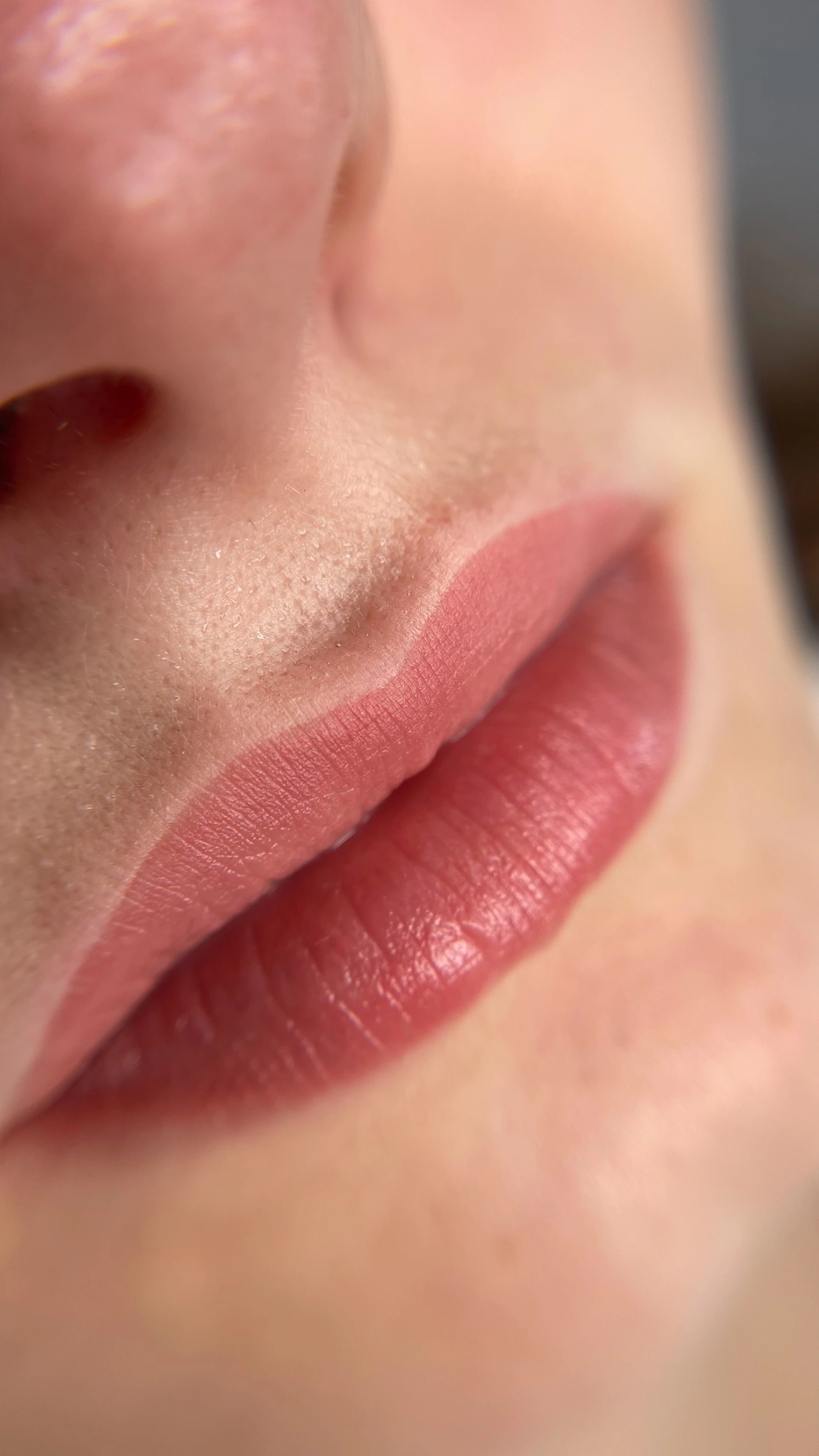 Lips. Abgeheilt.
