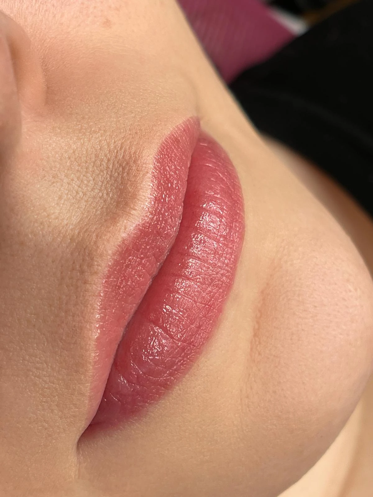 Abgeheilte Lippen in seitlicher Detailansicht.